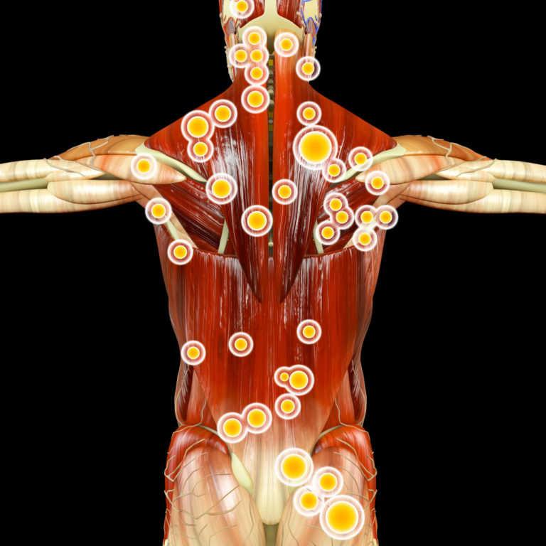 Schmerzen Im Bewegungsapparat – Therapie-naturheilkundezentrum.de